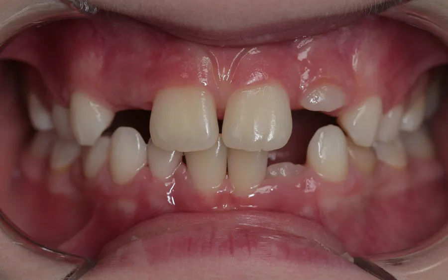 After treatment
