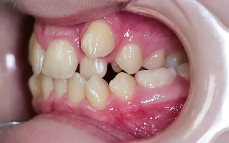 Before treatment