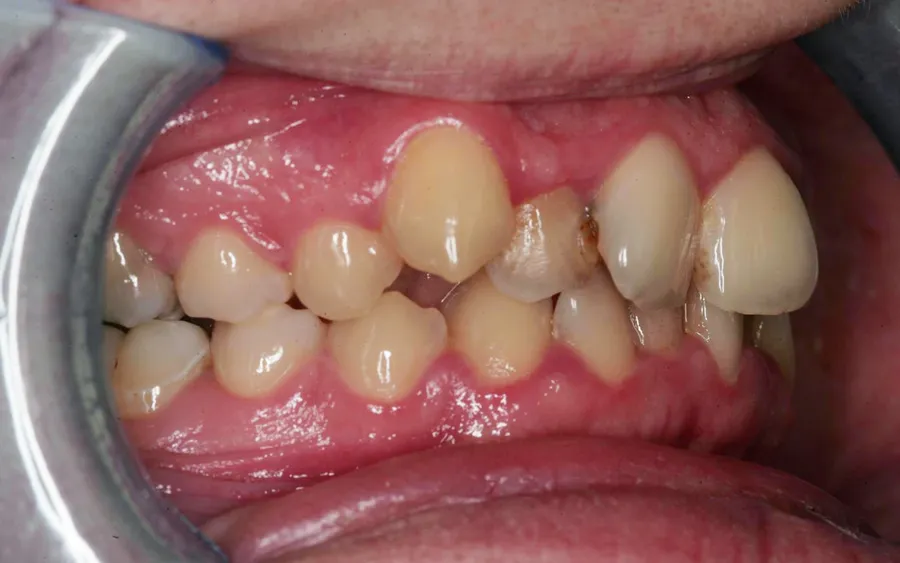 Before treatment