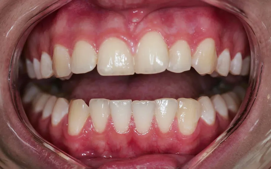 Before treatment